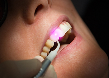 Laserbehandlung - Zahnarztpraxis Pioch